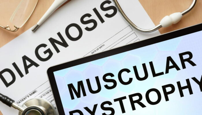 9 common types of muscular dystrophy and their symptoms