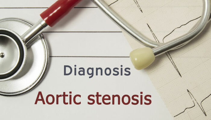 14 ways to prevent and manage aortic stenosis