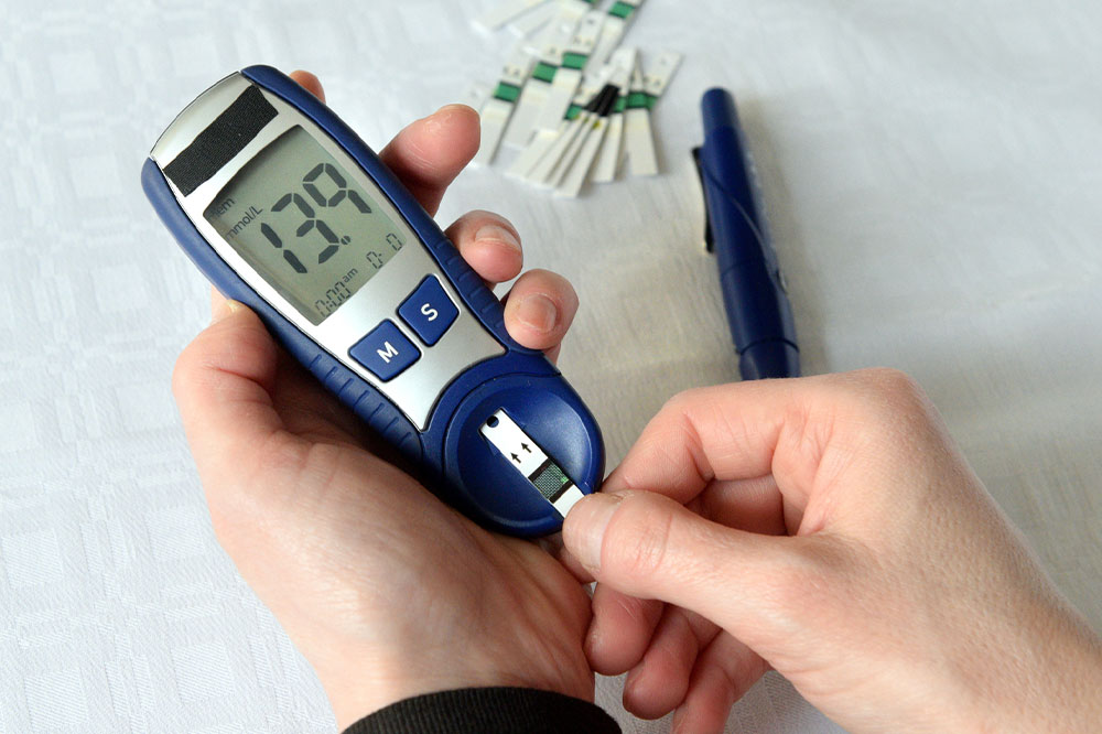 Hyperglycemia – Causes, Symptoms, and Management