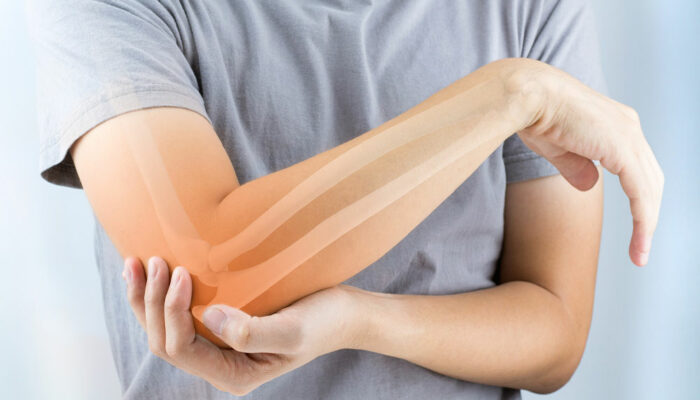 5 Health Conditions That May Trigger Osteoporosis and Bone Loss