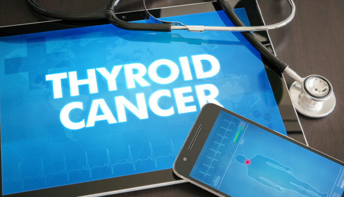 6 Silent Signs of Thyroid Cancer