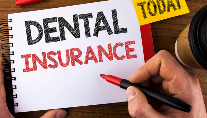 Top 4 things that dental insurance doesn’t cover